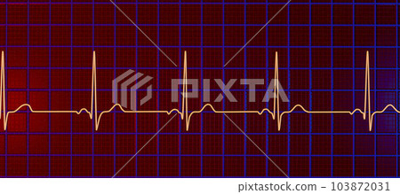 A normal electrocardiogram, 3D illustration displaying the electrical activity of the heart in a healthy individual, A normal electrocardiogram, 3D illustration displaying the electrical activity of the heart in a healthy individual, 103872031