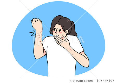 Woman frustrated with rash and dermatitis on body 103876197