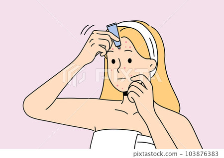 Woman apply cream on pimples on face  103876383