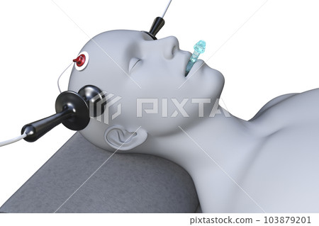 Electroconvulsive therapy, ECT, a treatment involving the use of electrical currents to stimulate the brain, 3D illustration 103879201