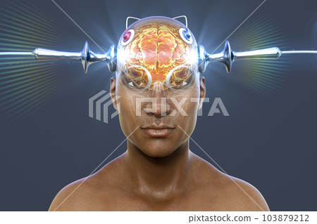Electroconvulsive therapy, ECT, a treatment involving the use of electrical currents to stimulate the brain, 3D illustration Electroconvulsive therapy, ECT, a treatment involving the use of electrical currents to stimulate the brain, 3D illustration 103879212