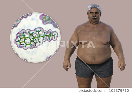 A 3D medical illustration featuring a senior overweight man with a close-up view of a cholesterol molecule A 3D medical illustration featuring a senior overweight man with a close-up view of a cholesterol molecule 103879710