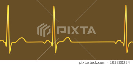 Electrocardiogram ECG displaying sinus arrhythmia, 3D illustration 103880254