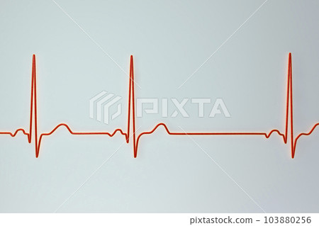 Electrocardiogram ECG displaying sinus arrhythmia, 3D illustration 103880256