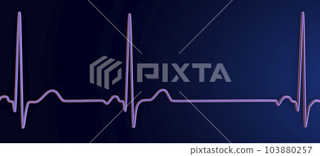 Electrocardiogram ECG displaying sinus arrhythmia, 3D illustration 103880257