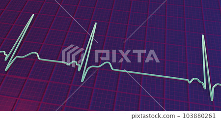 Electrocardiogram ECG displaying sinus arrhythmia, 3D illustration 103880261