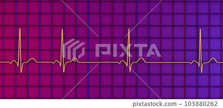 Electrocardiogram ECG displaying sinus arrhythmia, 3D illustration 103880262
