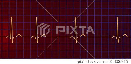Electrocardiogram ECG displaying sinus arrhythmia, 3D illustration 103880265