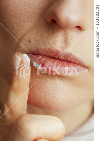 40 years old woman applying ointment using finger on beige 103882503