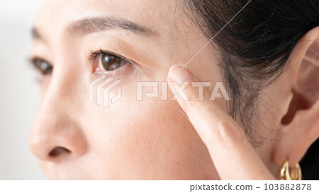 Middle-aged woman around the eyes 103882878