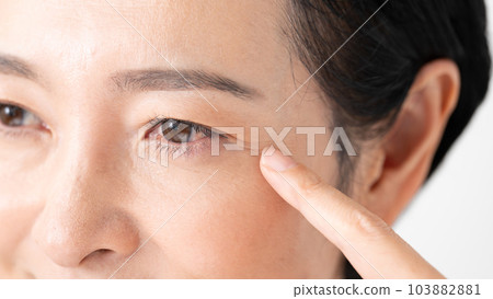 Middle-aged woman around the eyes 103882881