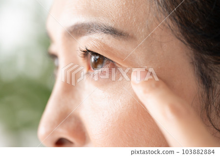 中年女人眼睛周圍 103882884