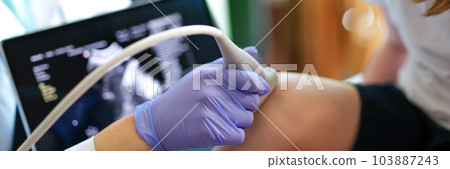 Specialist making ultrasound diagnostics of knee joint of little child Specialist making ultrasound diagnostics of knee joint of little child 103887243