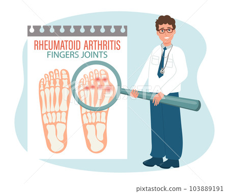 Rheumatoid arthritis. Osteoarthritis of the joints of the toes. Male doctor with a magnifying glass. Medical infographic banner, poster, vector 103889191