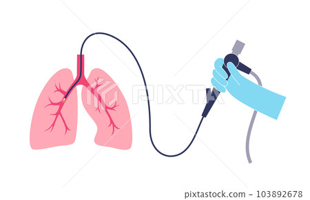 Bronchoscopy procedure concept 103892678