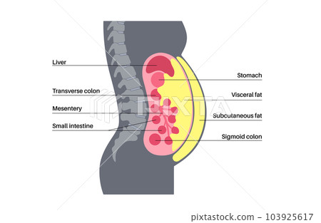 Visceral fat diagram 103925617