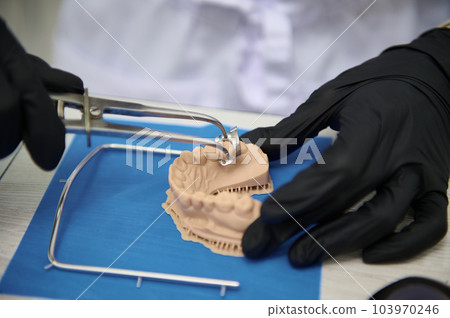 Close up. Selective focus on gypsum cast of human jaw. Dentist with black surgical gloves works on dental implant in medical lab. Prosthetic engineer at work. Extreme precision. Dentistry. Copy space Close up. Selective focus on gypsum cast of human jaw. Dentist with black surgical gloves works on dental implant in medical lab. Prosthetic engineer at work. Extreme precision. Dentistry. Copy space 103970246