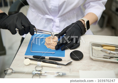 Close-up prosthetic engineer, dentist doctor, orthodontist working with gypsum cast of human jaw in medical clinical lab. Dental prosthesis. Dental implant. Cosmetic dentistry. Maxillofacial surgery. 103970247