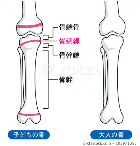 骨骺線 兒童骨骼和成人骨骼 103971353