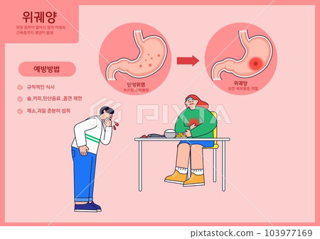 stomach ulcer stomach ulcer 103977169