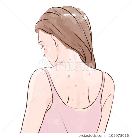 女人背部皮膚粗糙 103978016