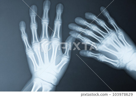 X-ray. X-ray of head, foot, head, mouth, ribs and hands. Bone scan. Body injury. X-ray analysis of human teeth. Xray of a human thorax isolated X-ray. X-ray of head, foot, head, mouth, ribs and hands. Bone scan. Body injury. X-ray analysis of human teeth. Xray of a human thorax isolated 103978629