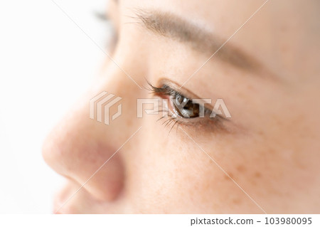 老年斑黃褐斑青春痘女性 103980095