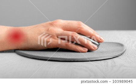 Wrist pain concept. Hand lying on computer mouse 103989045