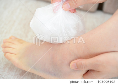 扭傷了女人的腿 103996498