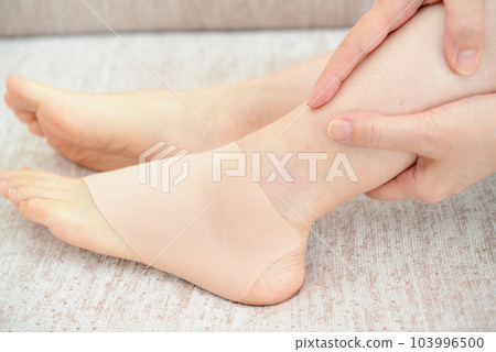 扭傷了女人的腿 扭傷了女人的腿 103996500