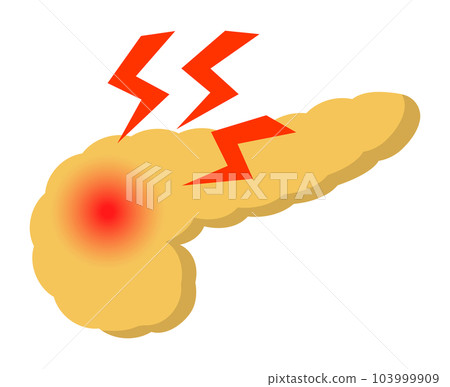 pancreatic disorder 103999909