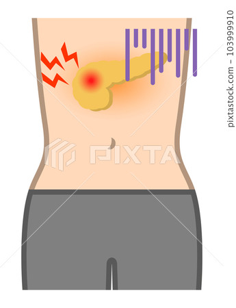 pancreatic disorder 103999910