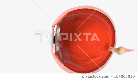 The cornea is the transparent, outer dome forming the anterior (front) portion of the eye. The cornea is the transparent, outer dome forming the anterior (front) portion of the eye. 104005080