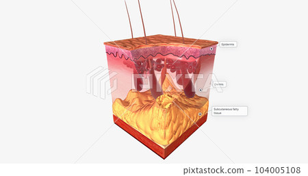 The Excisional Biopsy Close Up 104005108
