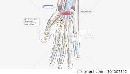 Carpal Tunnel Syndrome - Wrist Pain isolated on white (transparent bones) Carpal Tunnel Syndrome - Wrist Pain isolated on white (transparent bones) 104005112
