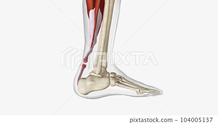 Flexion and Extension with Torn Achilles Tendon 104005137