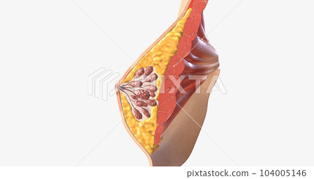 The female breast is composed of specialized glandular tissue, ducts, and fat, with an underlying layer of muscle. The female breast is composed of specialized glandular tissue, ducts, and fat, with an underlying layer of muscle. 104005146