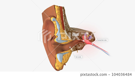 Earache is a general term for pain in the ear. 104036484