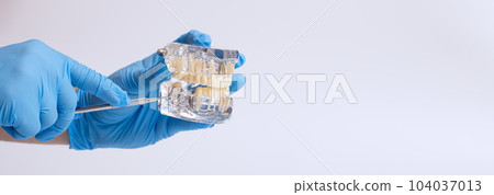 Dentist's hand in a blue glove holds a dental jaw model indicates a missing tooth 104037013