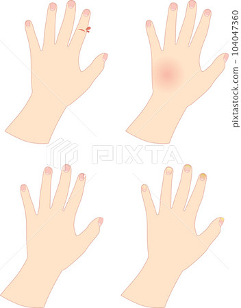 粗糙的女性手 4 種類型設置 _1 104047360