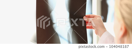 Doctor looks at x-ray film of knee joint before treatment Doctor looks at x-ray film of knee joint before treatment 104048187