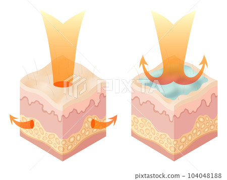 Protection uv ray skin. Illustration about Skin care concept. Sun protection body adipose layers epidermis, vector infographic 104048188