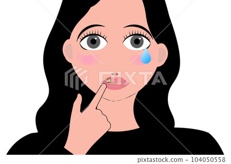 lip herpes 104050558