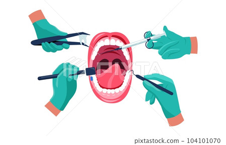 Dental treatment. Dentist hands in medical rubber gloves with instruments working on patient mouth, oral care concept. Vector cartoon illustration 104101070