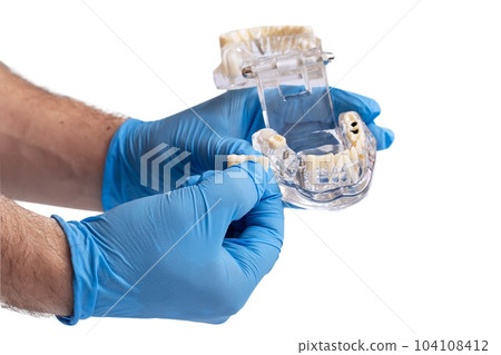 In hand dentists dental teeth teaching model showing each tooth, gum, root, implant, decay, plaque and enamel. In hand dentists dental teeth teaching model showing each tooth, gum, root, implant, decay, plaque and enamel. 104108412