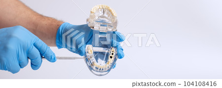 Dentist's hand in a blue glove holds a dental jaw model indicates a missing tooth 104108416