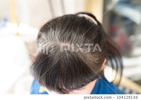 Head of an elderly woman with gray hair that grew after dyeing 104129138