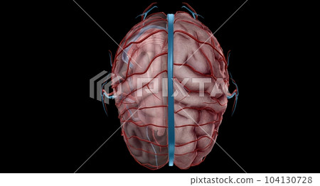 Arterial Supply to the Brain 104130728
