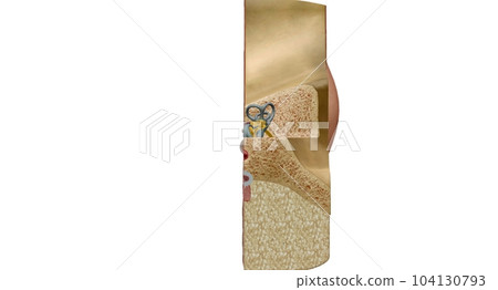 An ear is the organ that enables hearing and, in mammals, body b 104130793