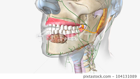Once a tumor has spread into nearby lymph nodes, it is considered a stage three cancer. 104131089